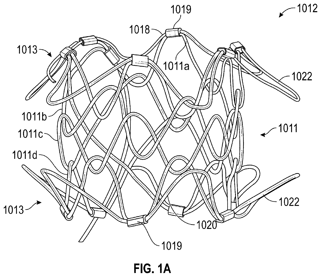 Percutaneous Potts Shunt Devices and Related Methods