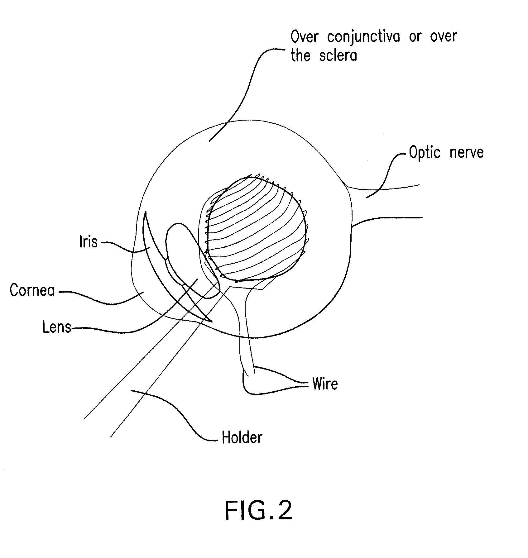 Method and composition for hyperthermally treating cells