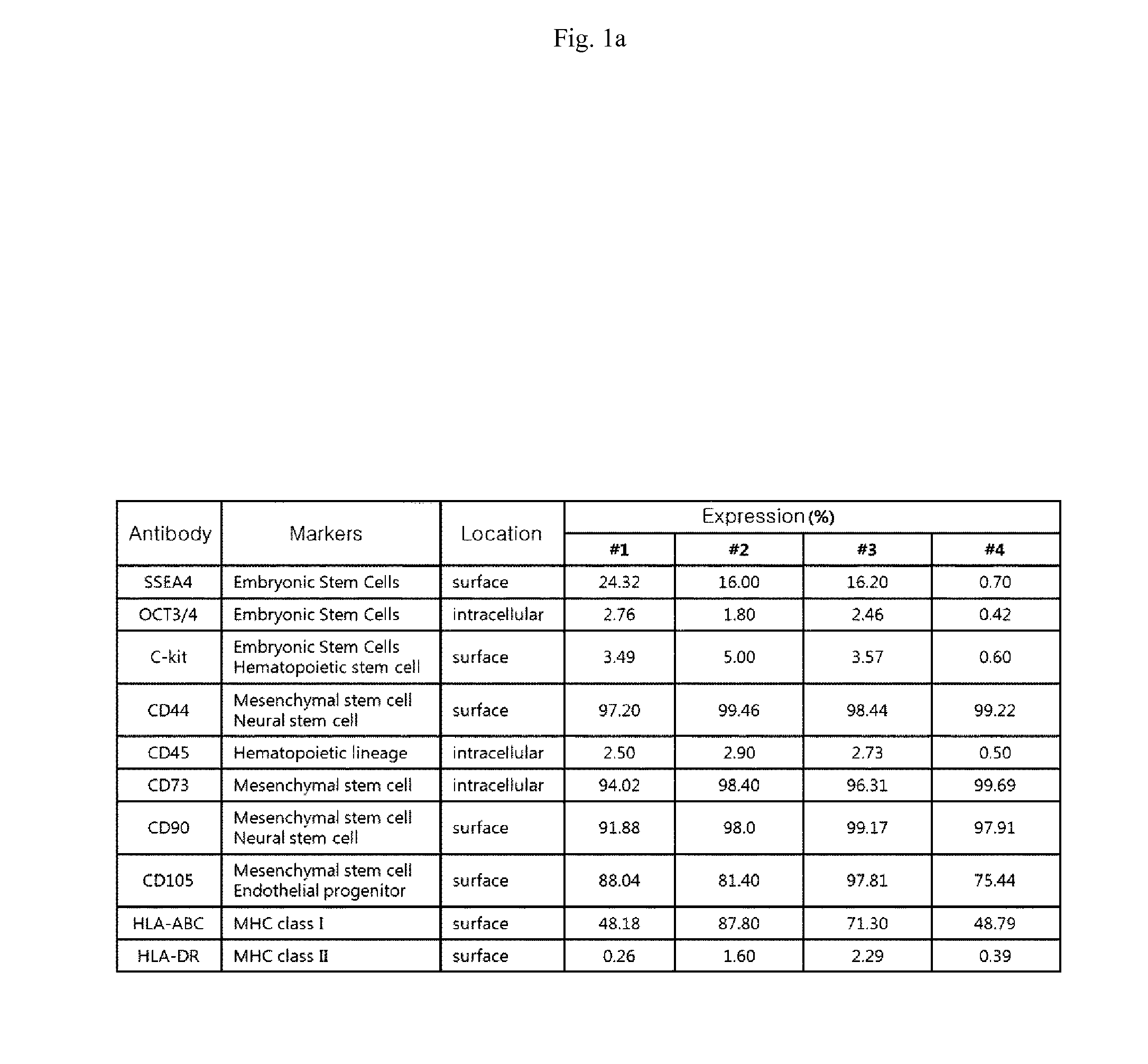 Agent for Treating Urinary Incontinence Including Stem Cells Derived from Amniotic Fluid