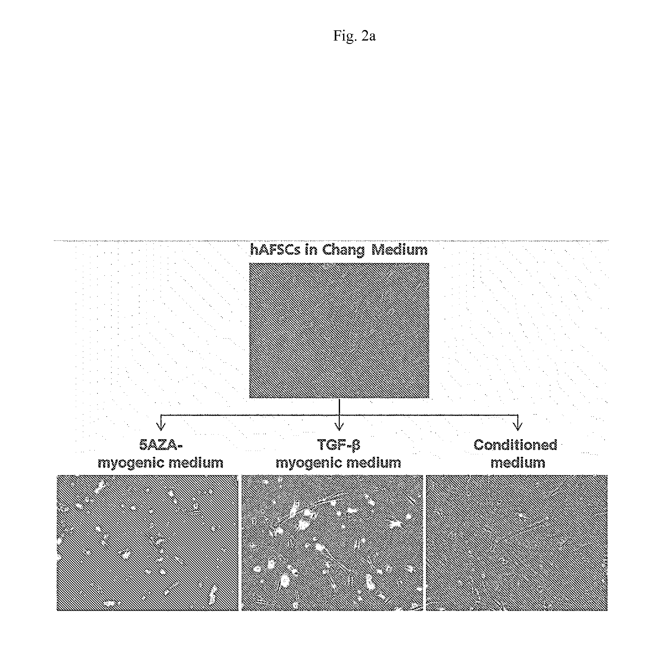 Agent for Treating Urinary Incontinence Including Stem Cells Derived from Amniotic Fluid