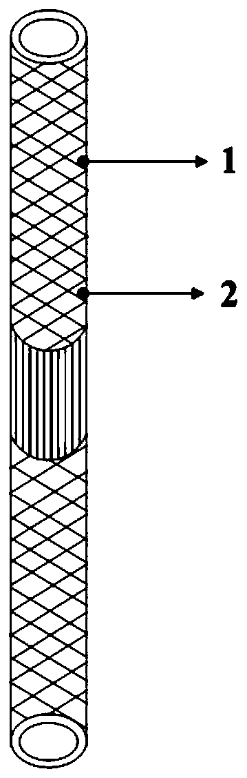 Biomimetic full-molded three-phase structure artificial ligament and preparation method thereof