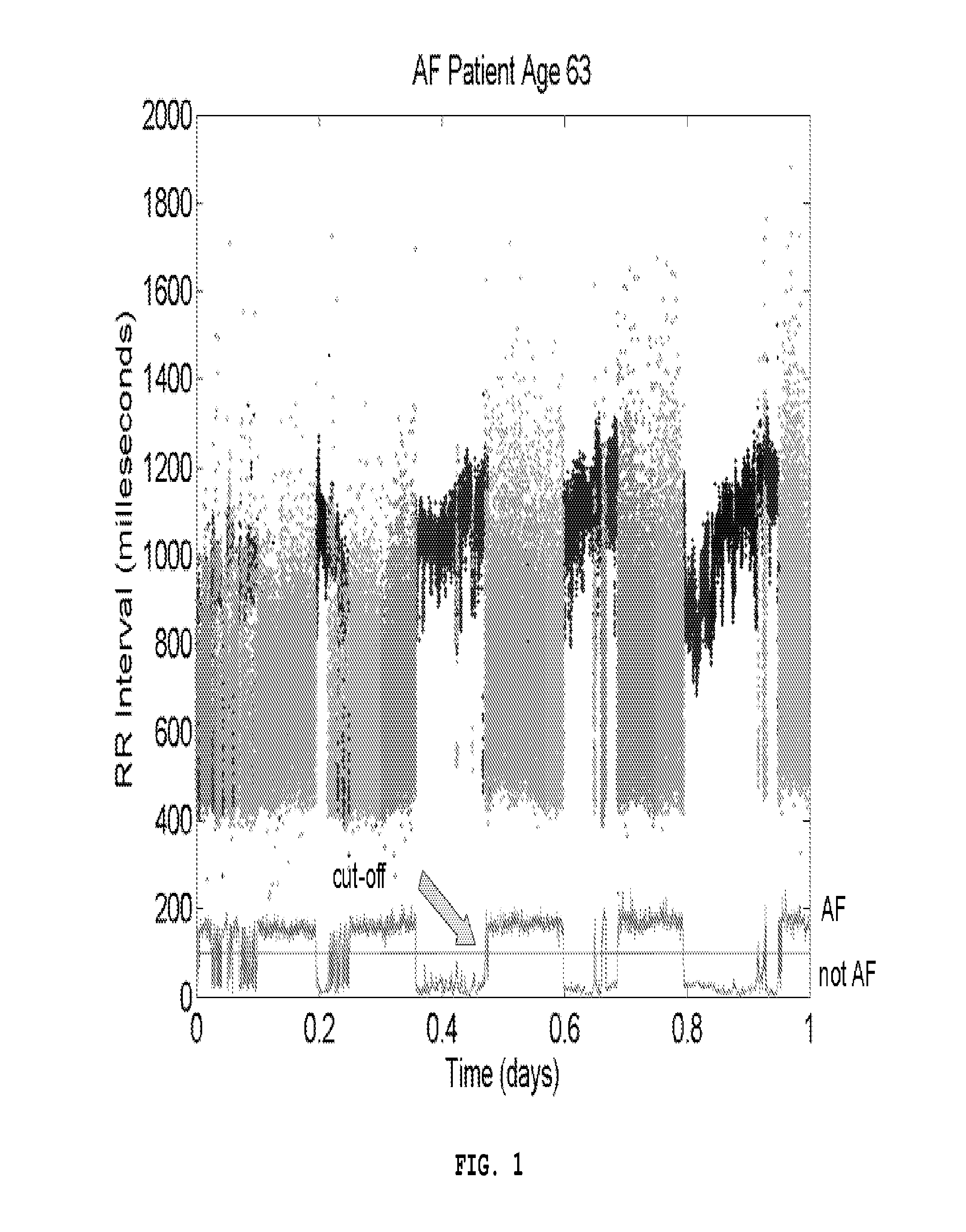 Method, system and computer program product for non-invasive classification of cardiac rhythm