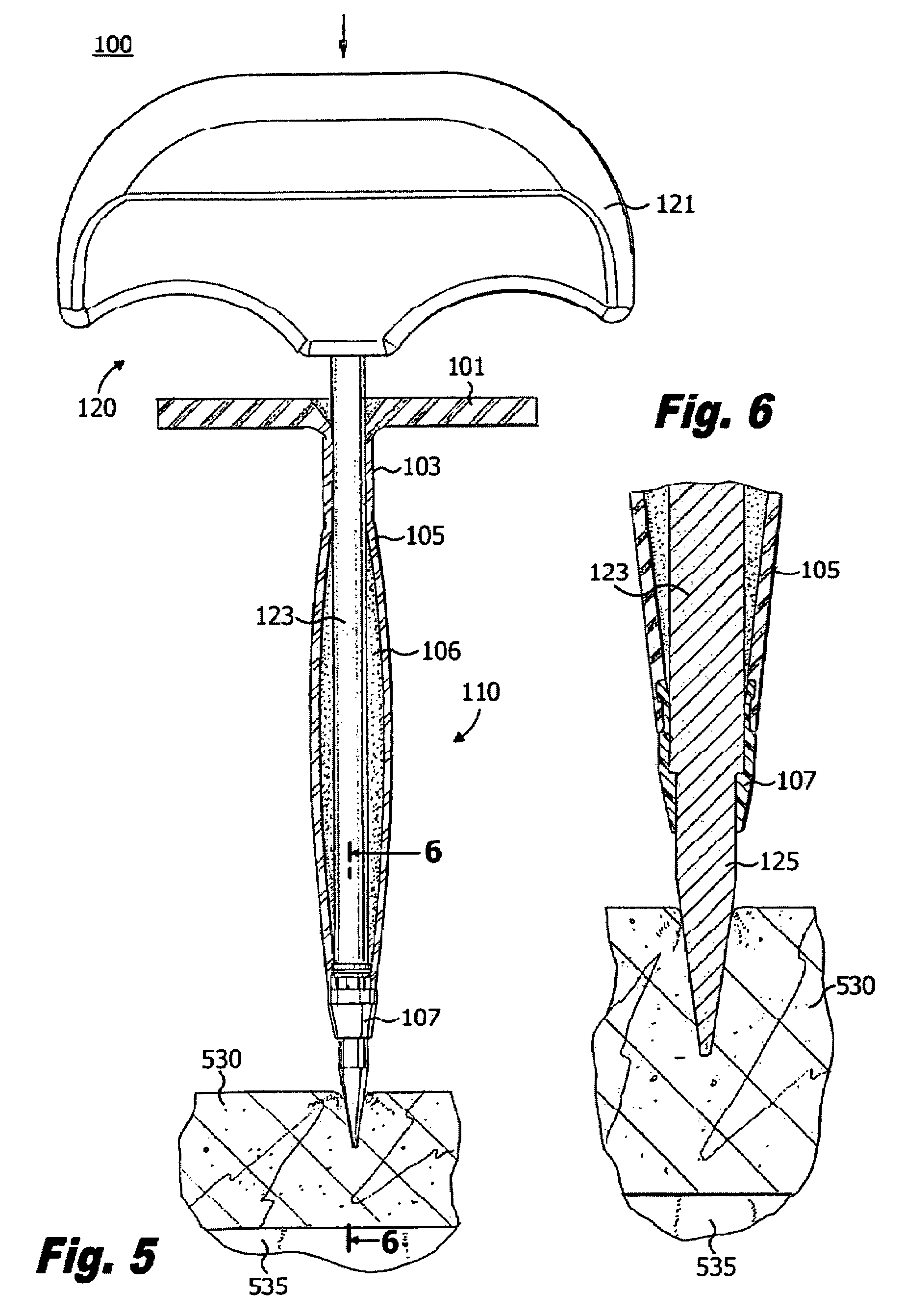 Elastically deformable surgical access device