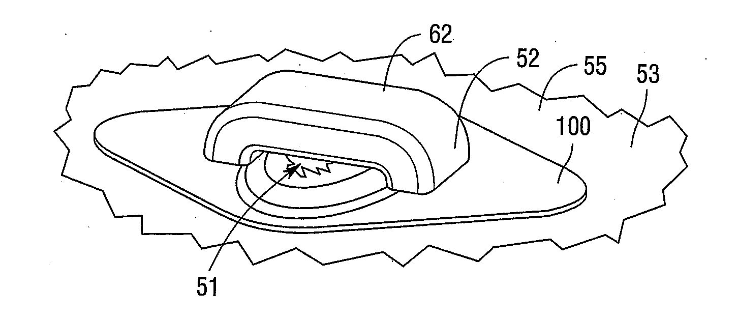 Wound care bandage and method of wound healing