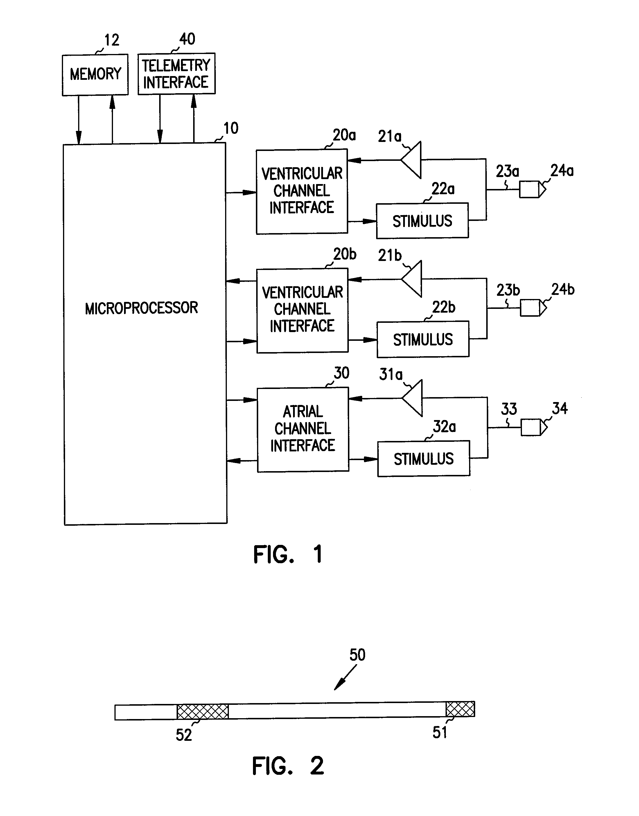 Apparatus and method for spatially and temporally distributing cardiac electrical stimulation