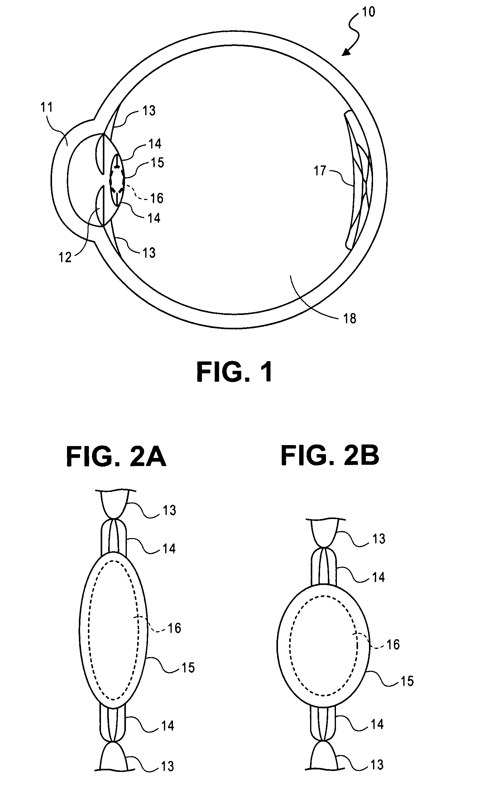 Accommodating intraocular lens system having circumferential haptic support and method