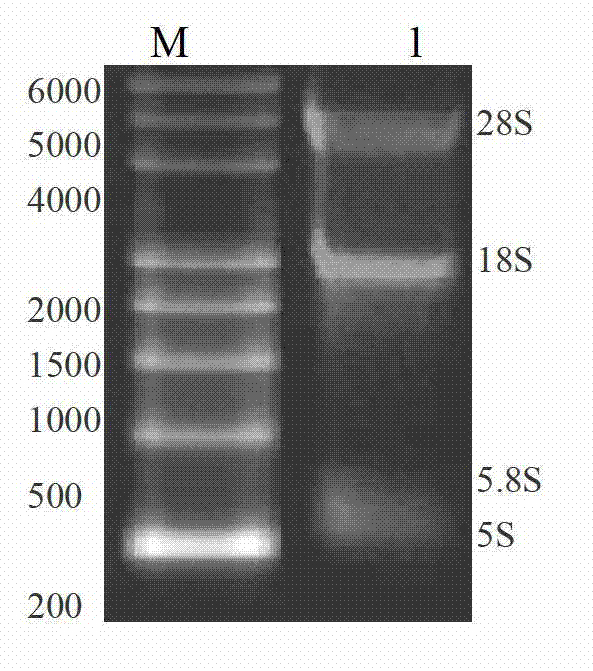 Recombined vessel endothelium growth factor receptor, encoding genes thereof and application