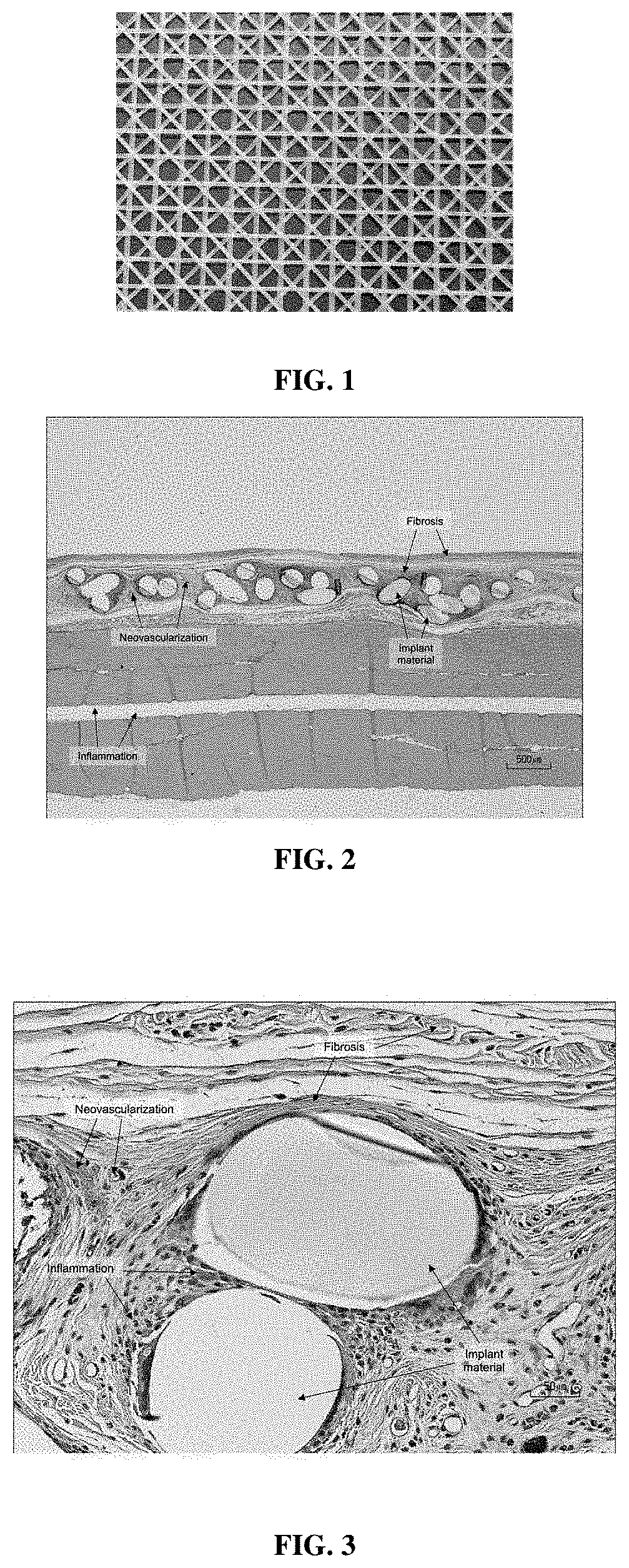 Medical devices containing compositions of poly(butylene succinate) and copolymers thereof