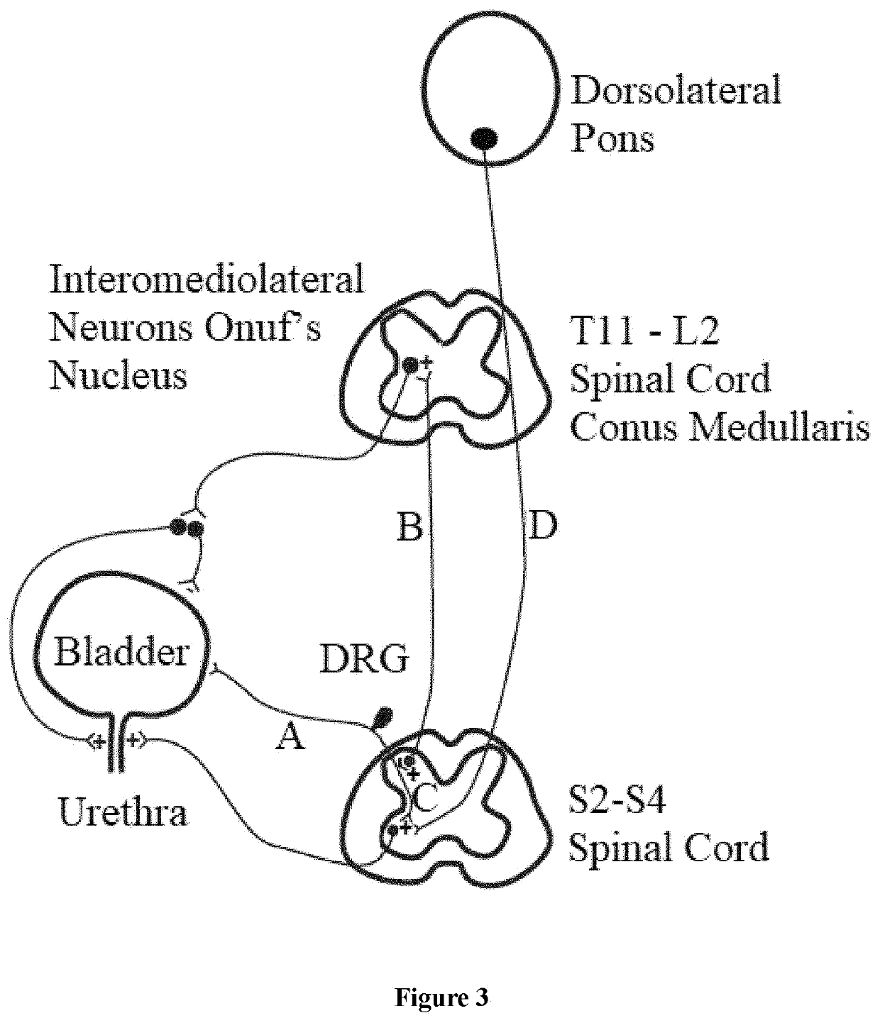 Method for treating overactive bladder and secondary fecal incontinence by neurostimulating two nerve sites