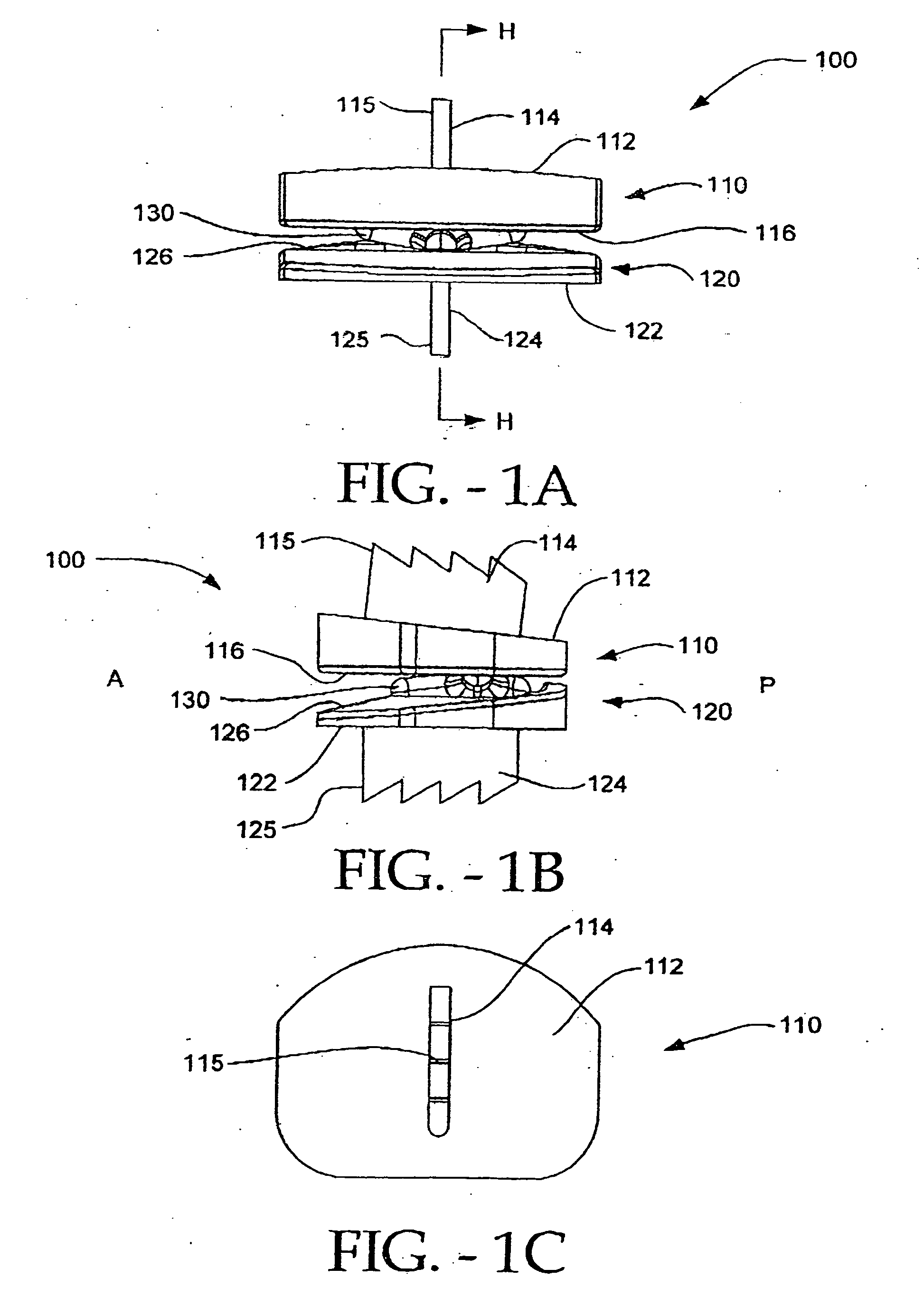Artificial vertebral disk replacement implant with crossbar spacer and method