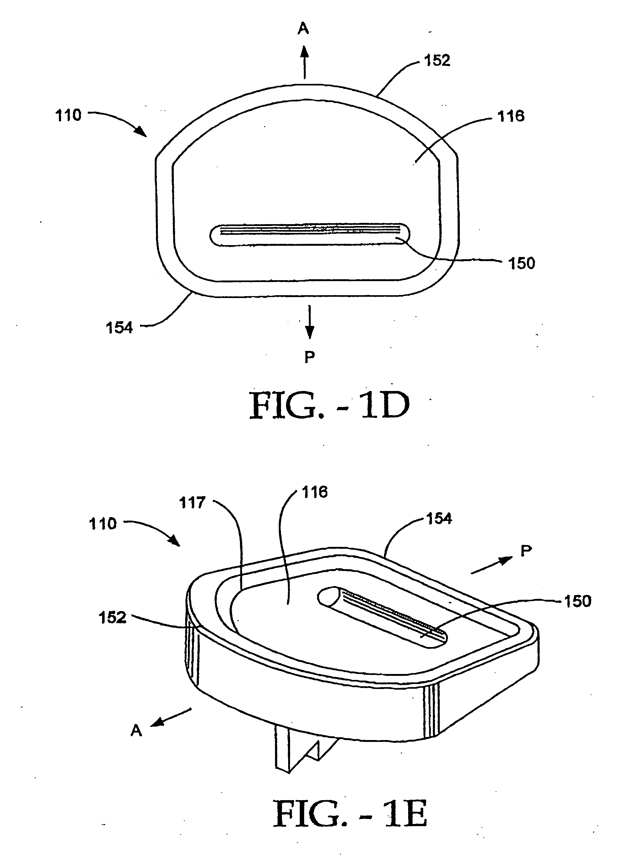 Artificial vertebral disk replacement implant with crossbar spacer and method