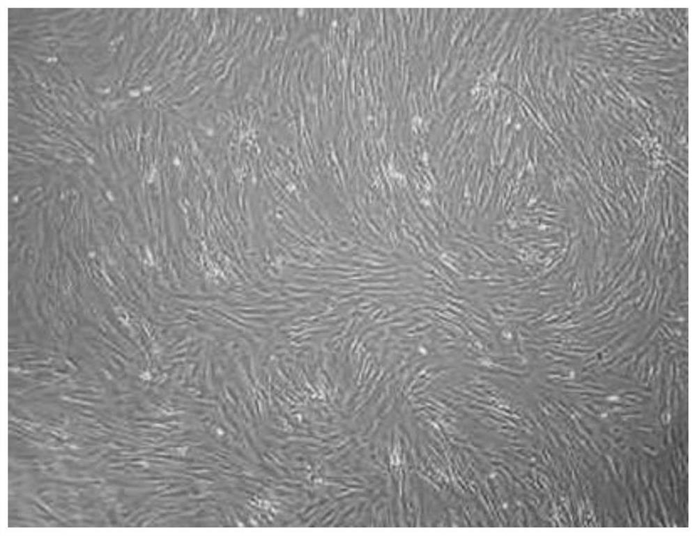 Application of AhR inhibitor to induction of chondrogenic differentiation of mesenchymal stem cells and treatment of related diseases