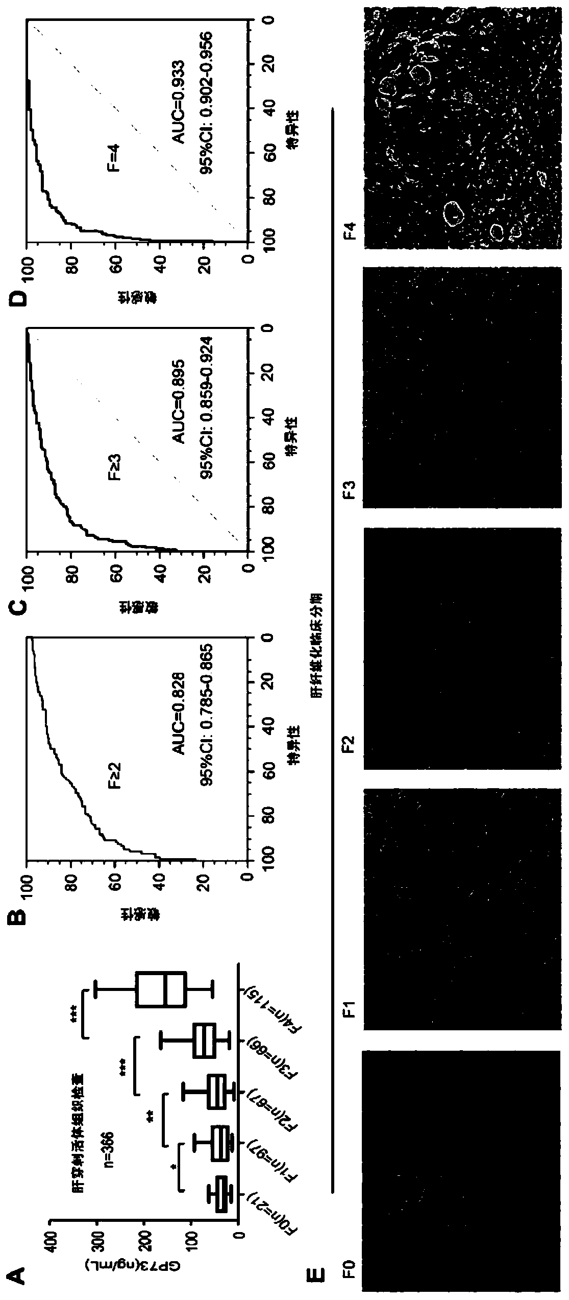 Novel marker of liver cirrhosis or liver fibrosis