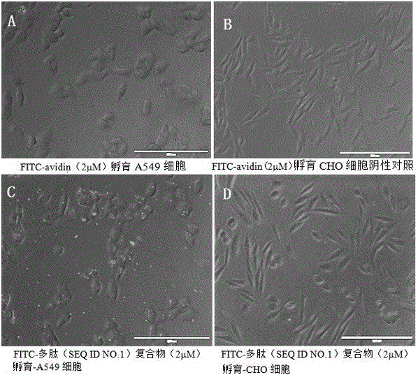 Double-targeting chimeric peptide and application thereof in preparation of anti-tumor metastasis drug