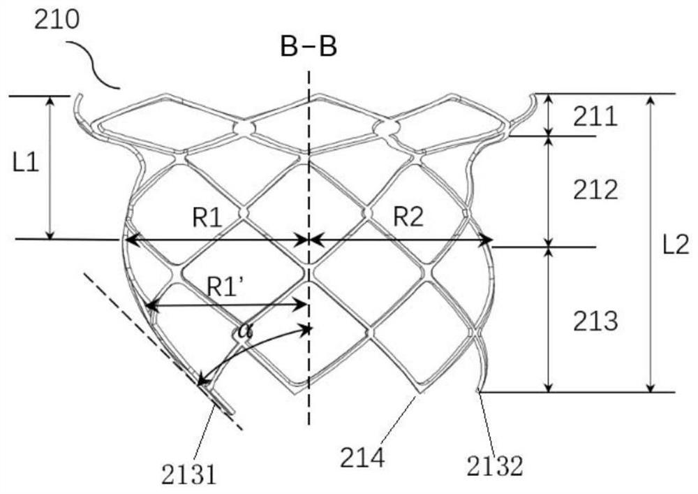 Cardiac valve prosthesis