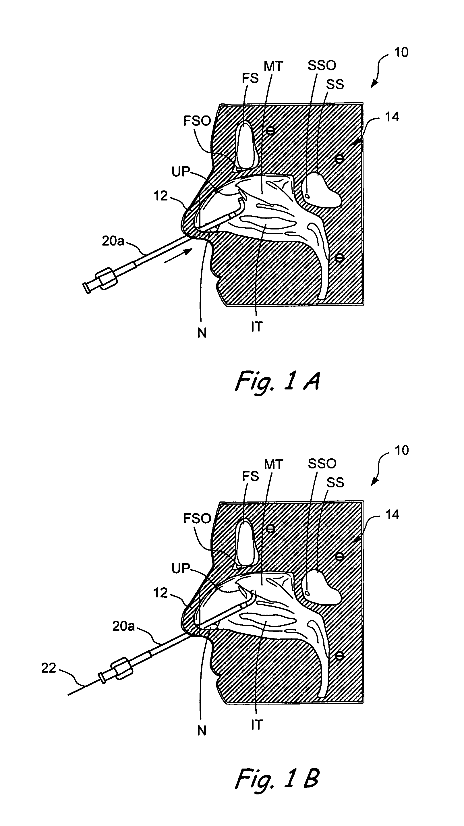 Anatomical models and methods for training and demonstration of medical procedures
