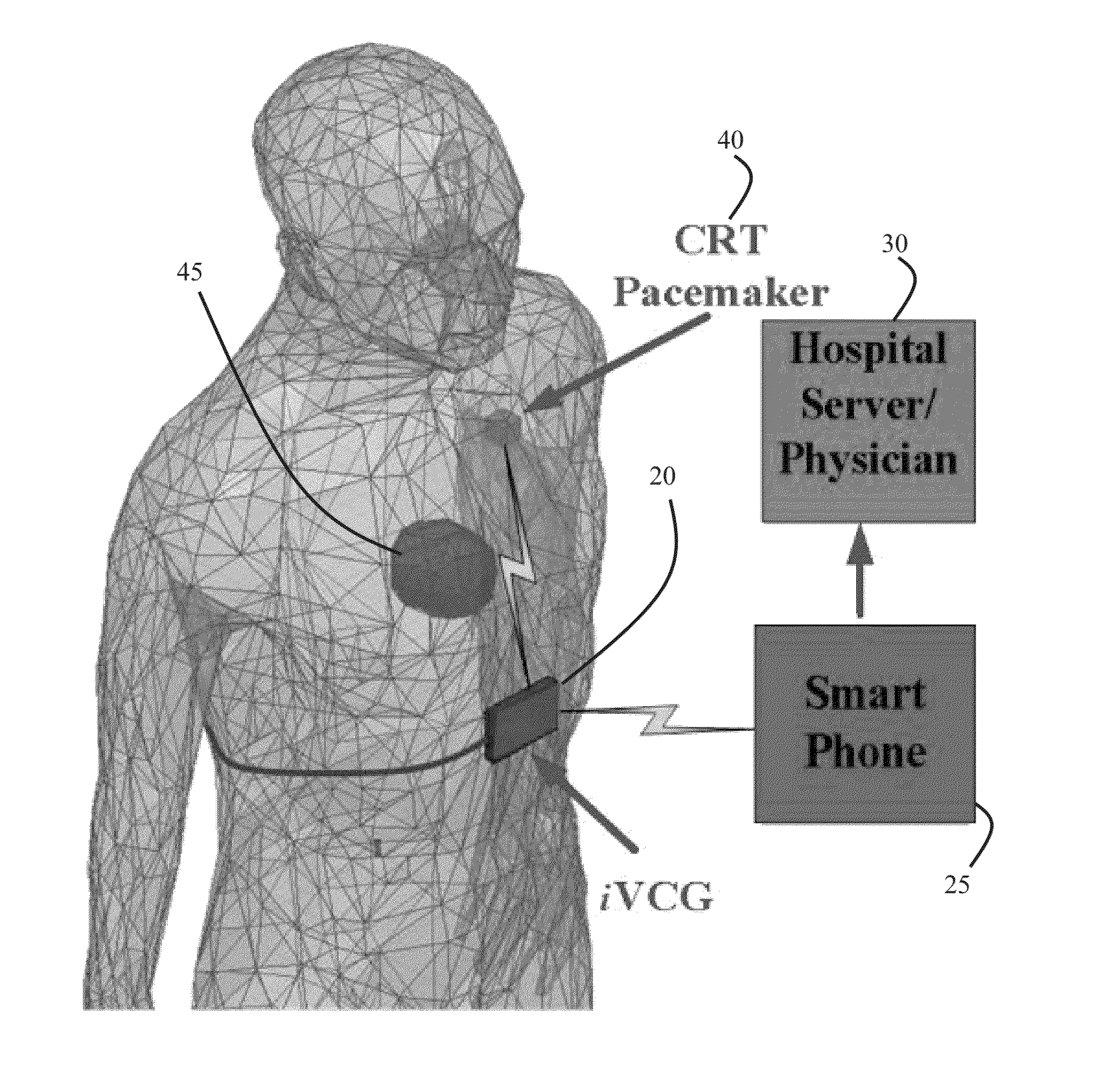 Integrated vectorcardiogram system and method of use