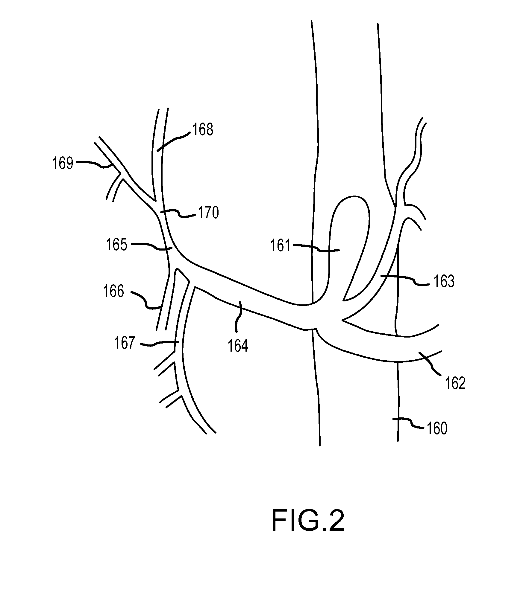 Augmented delivery catheter and method