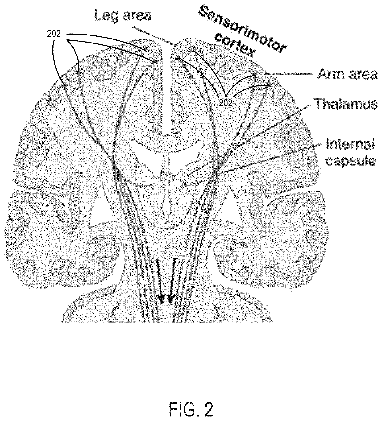 Systems and Methods for a Simulator for Brain Mapping