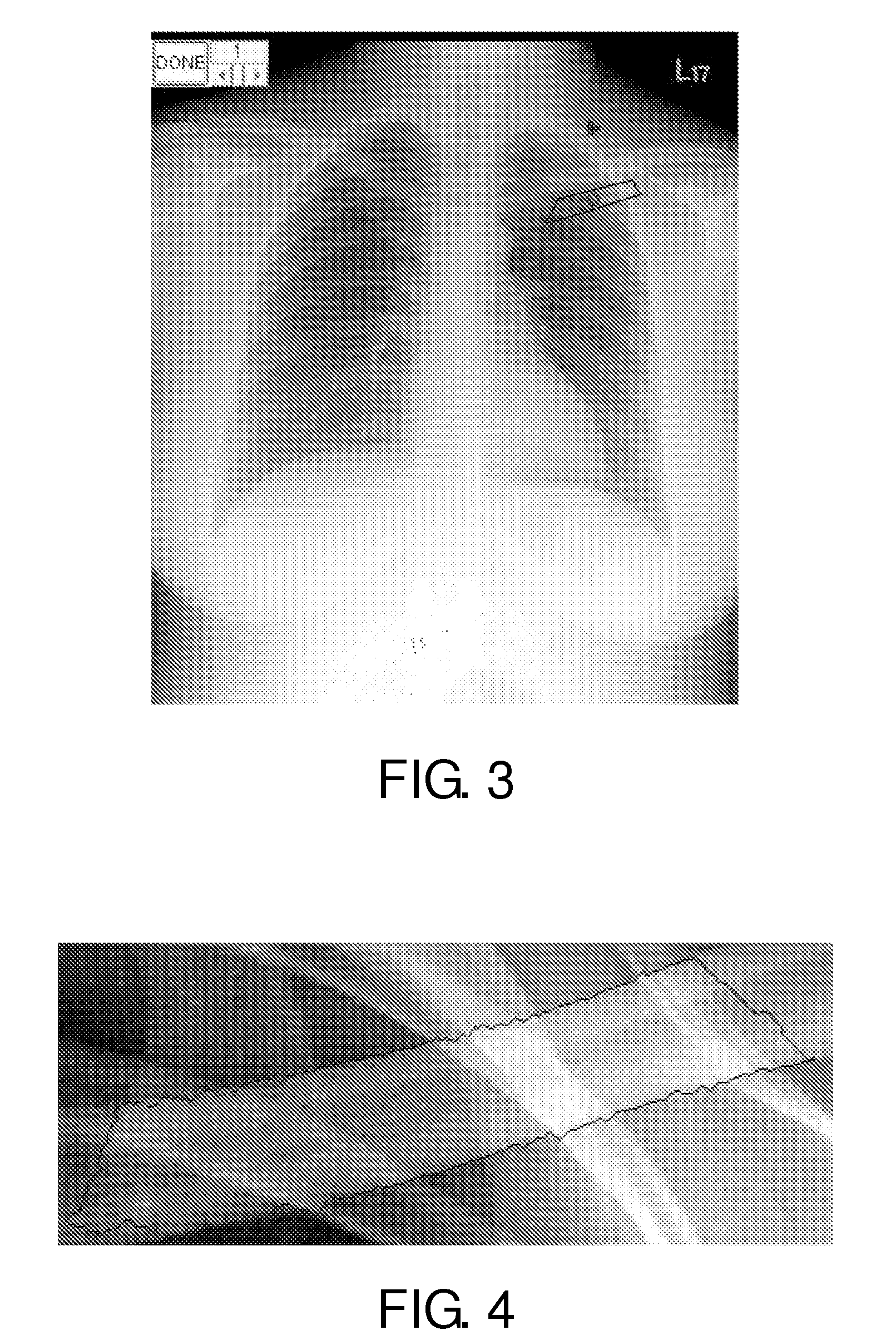 Method for assessing bone status