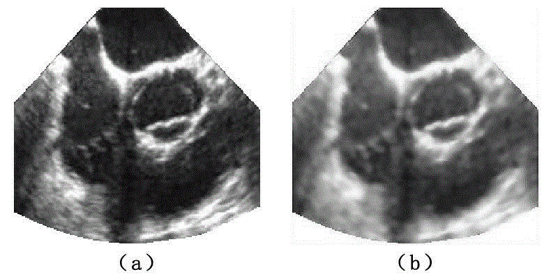 Method for segmenting aortic-valve ultrasound image sequence based on interframe-shape-constraint GCV model