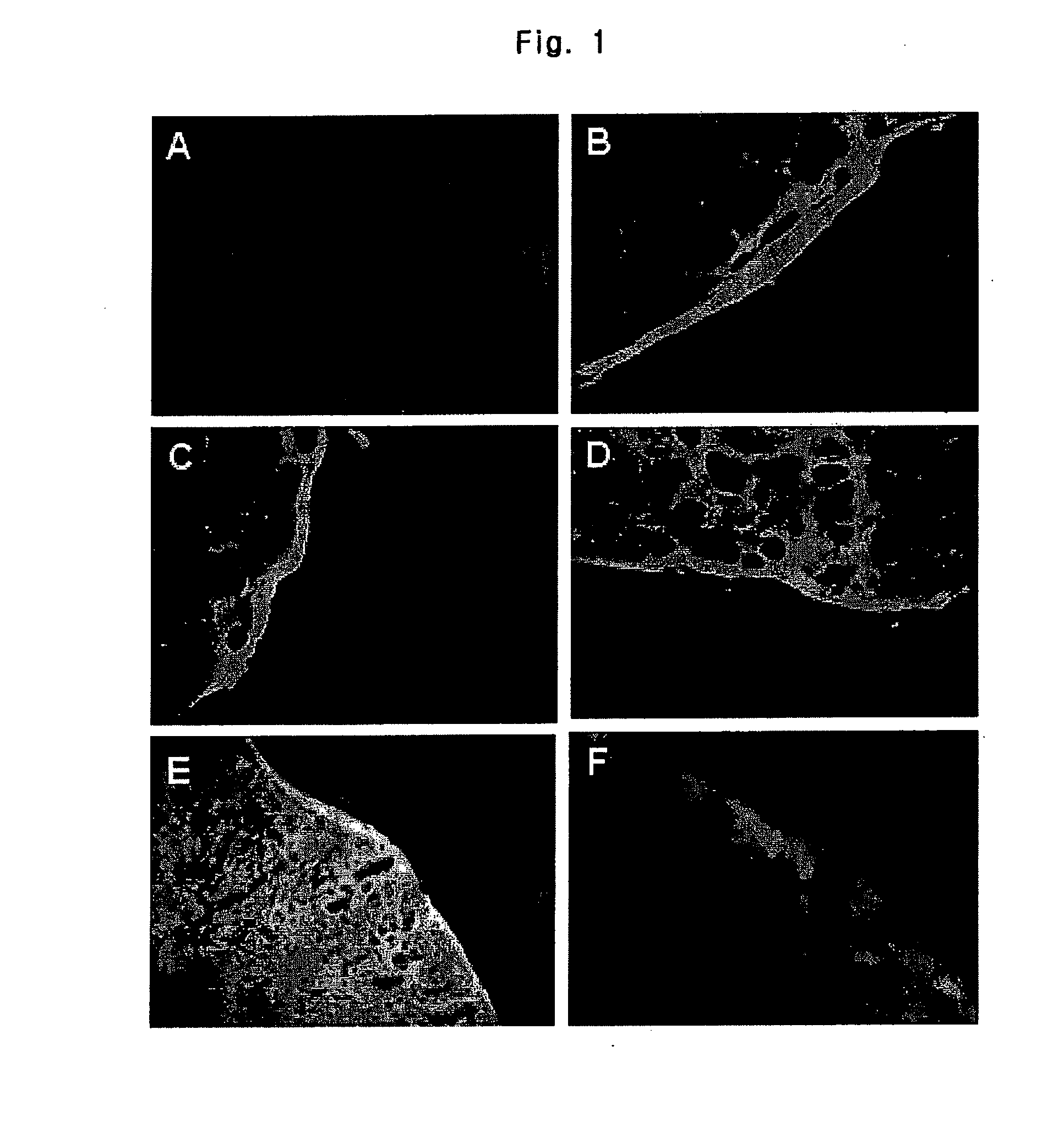 Inositol and trehalose derivatives and pharmaceutical compositions for treating neurodegenerative diseases comprising the same