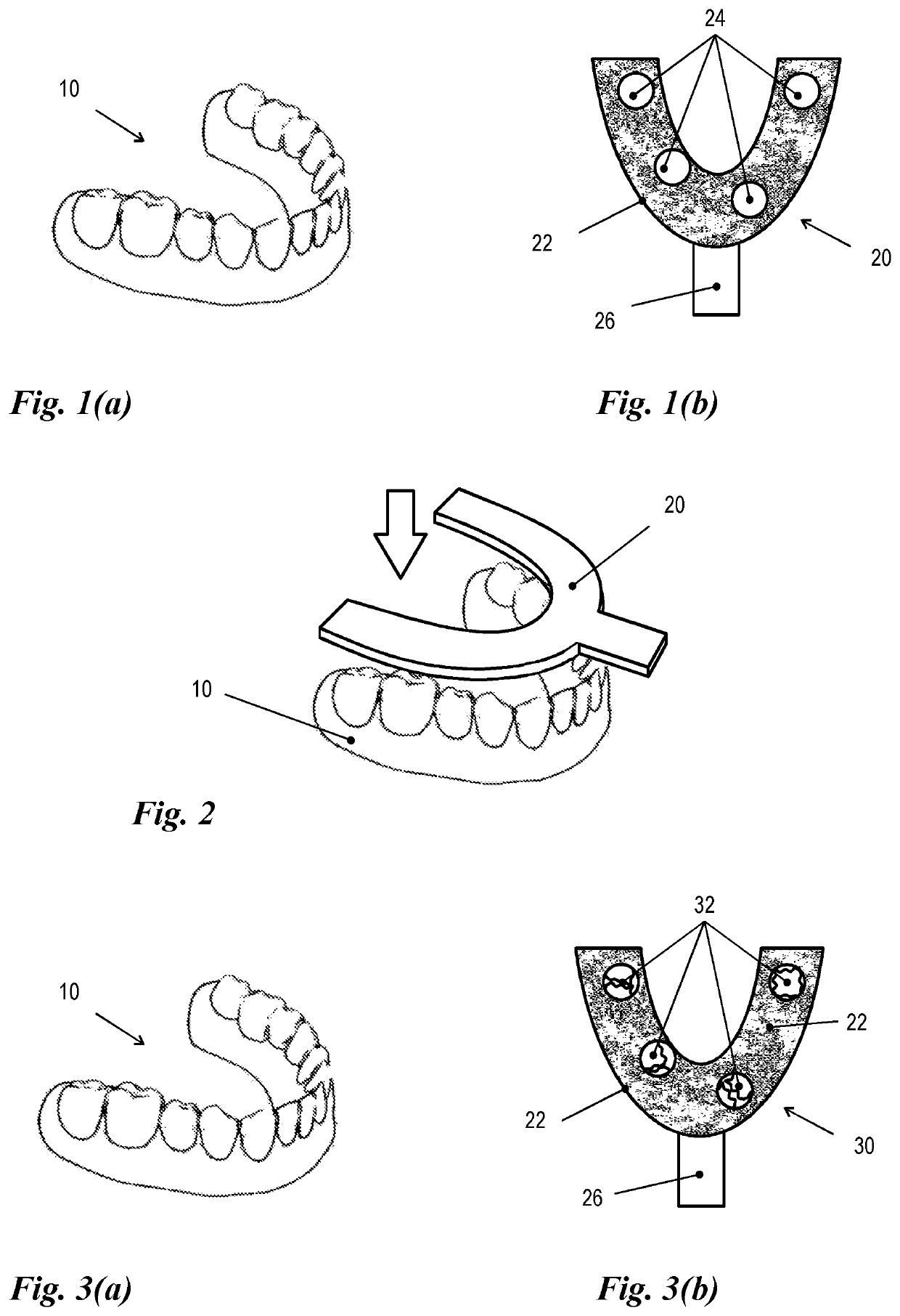 Method for virtually modeling a dental arch