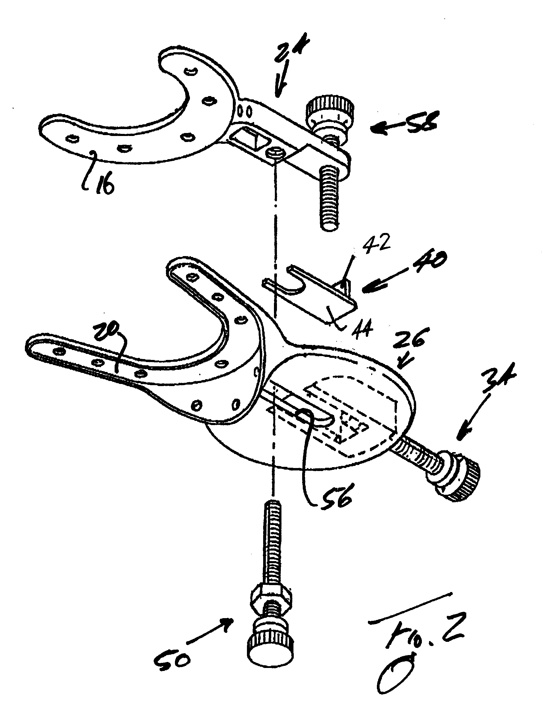 Mandible positioning devices