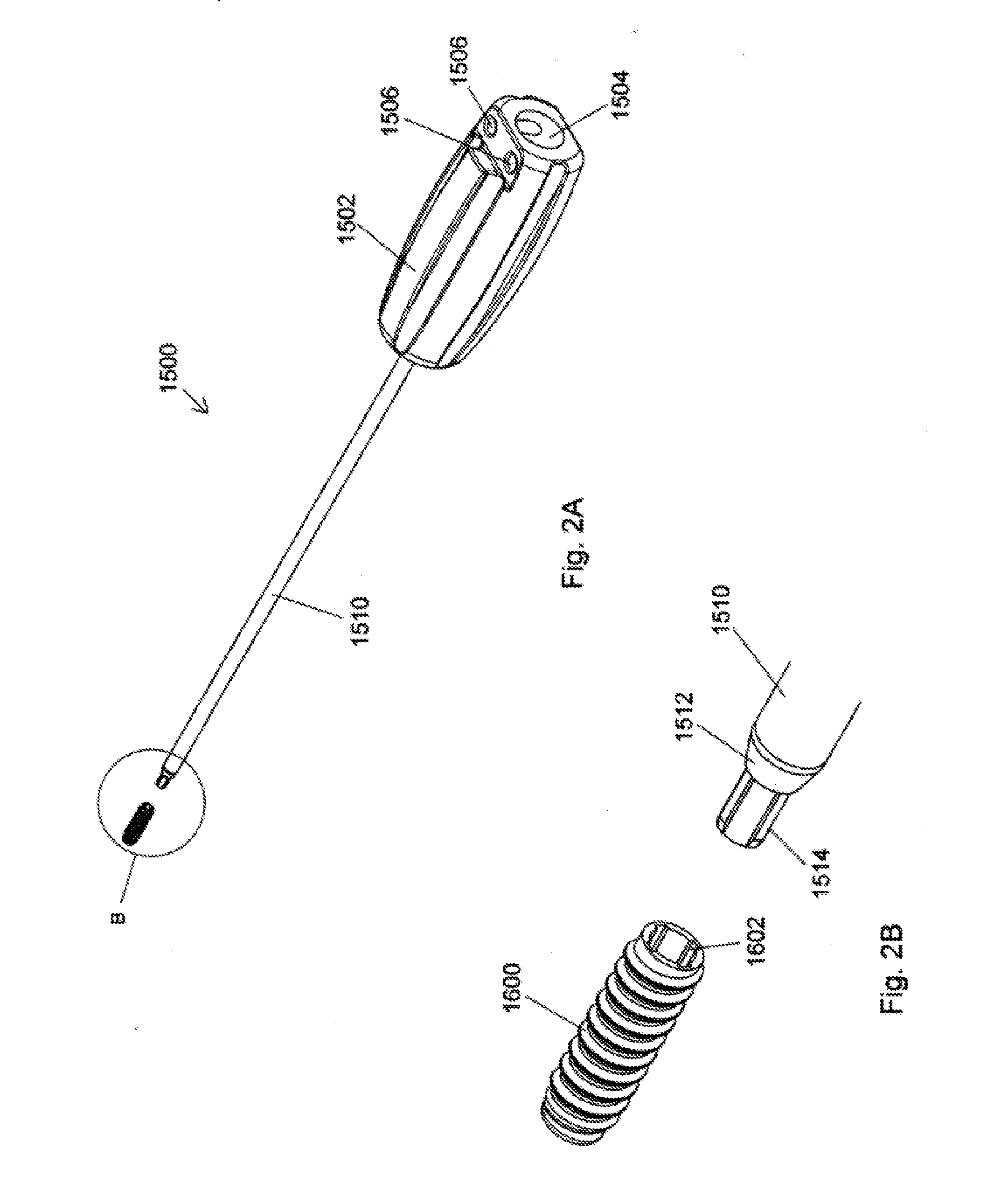 Implant placement systems and one-handed methods for tissue fixation using same