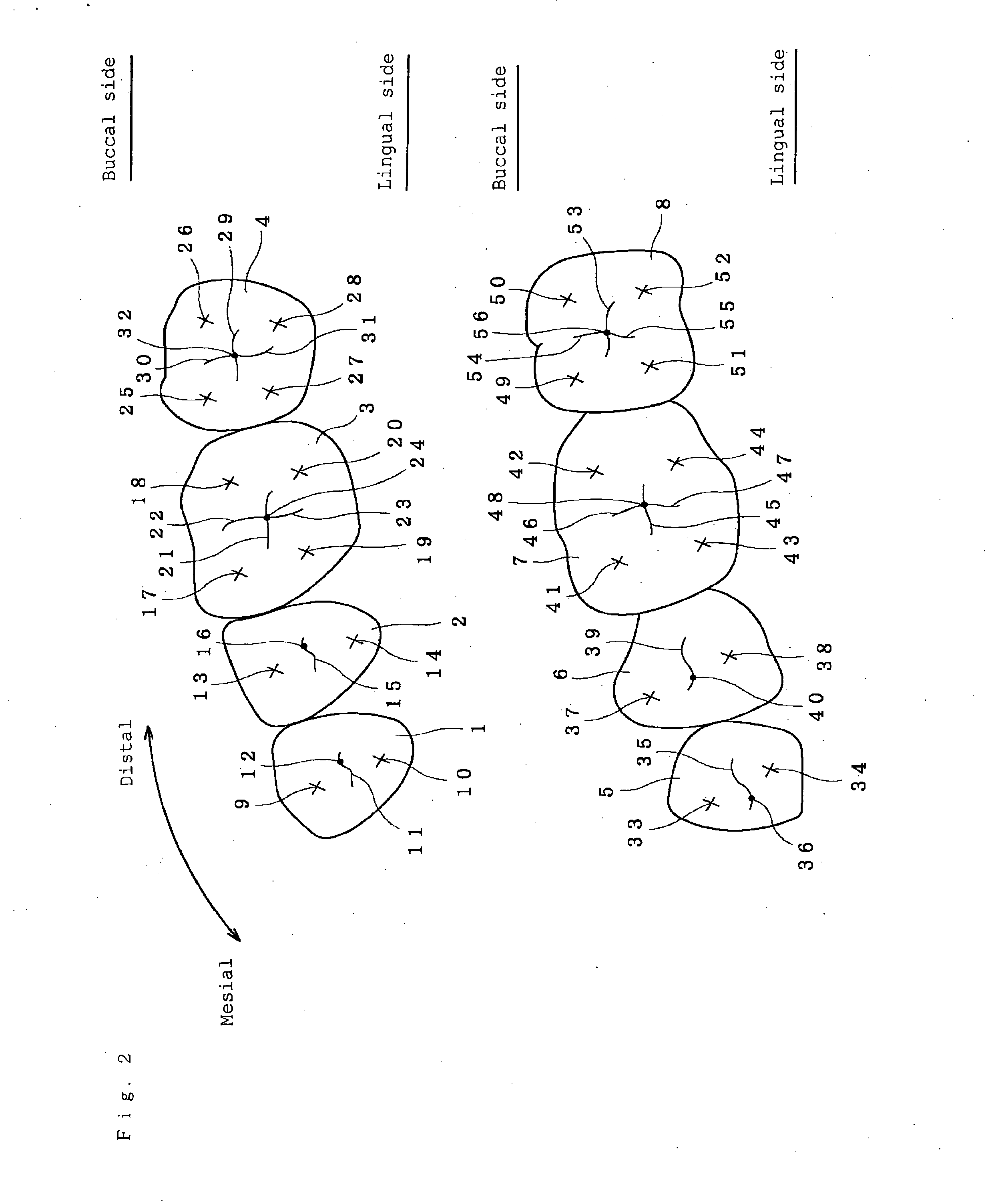 Artificial teeth