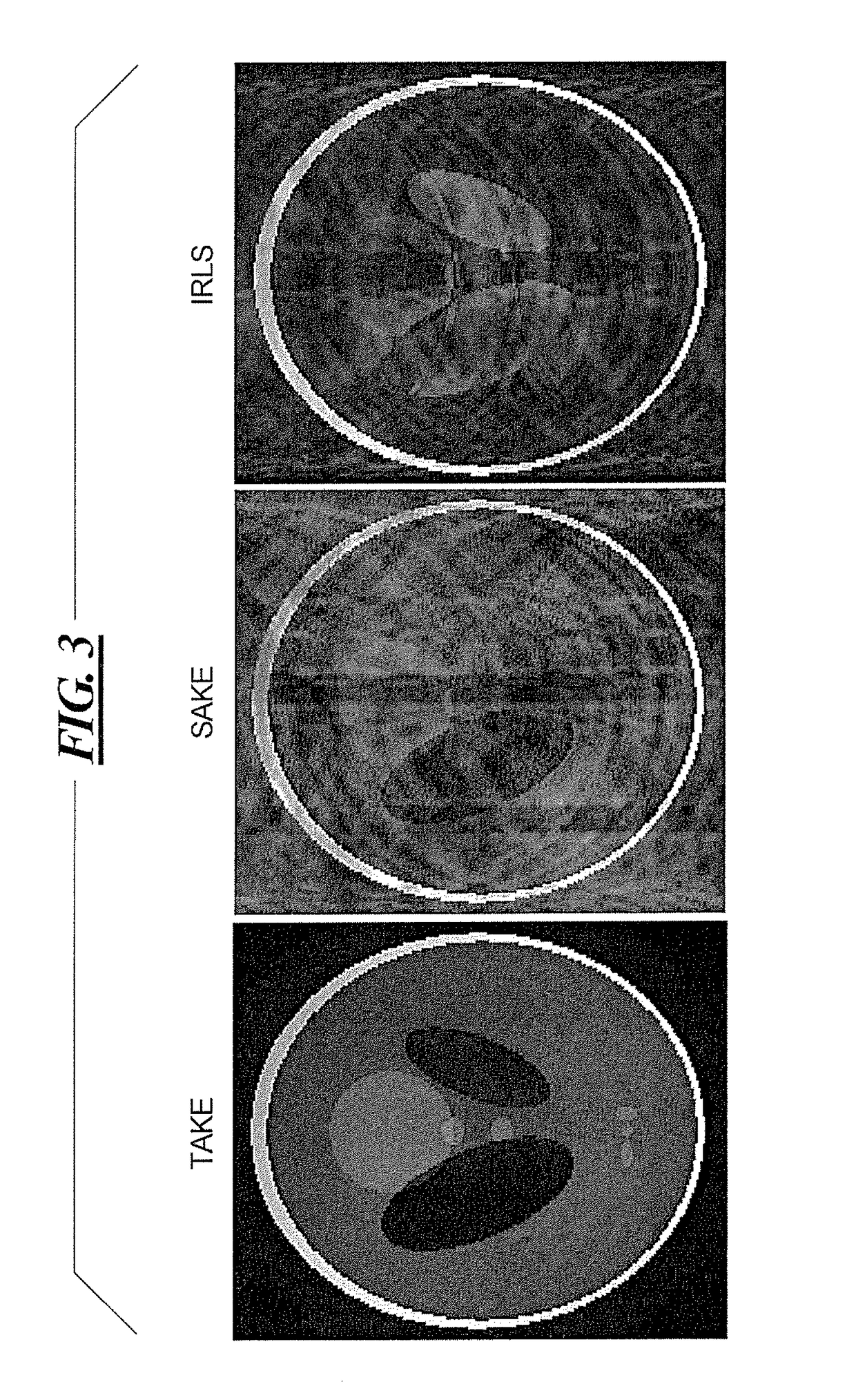 Method and magnetic resonance apparatus for image reconstruction with trimmed autocalibrating k-space estimation based on structured matrix completion