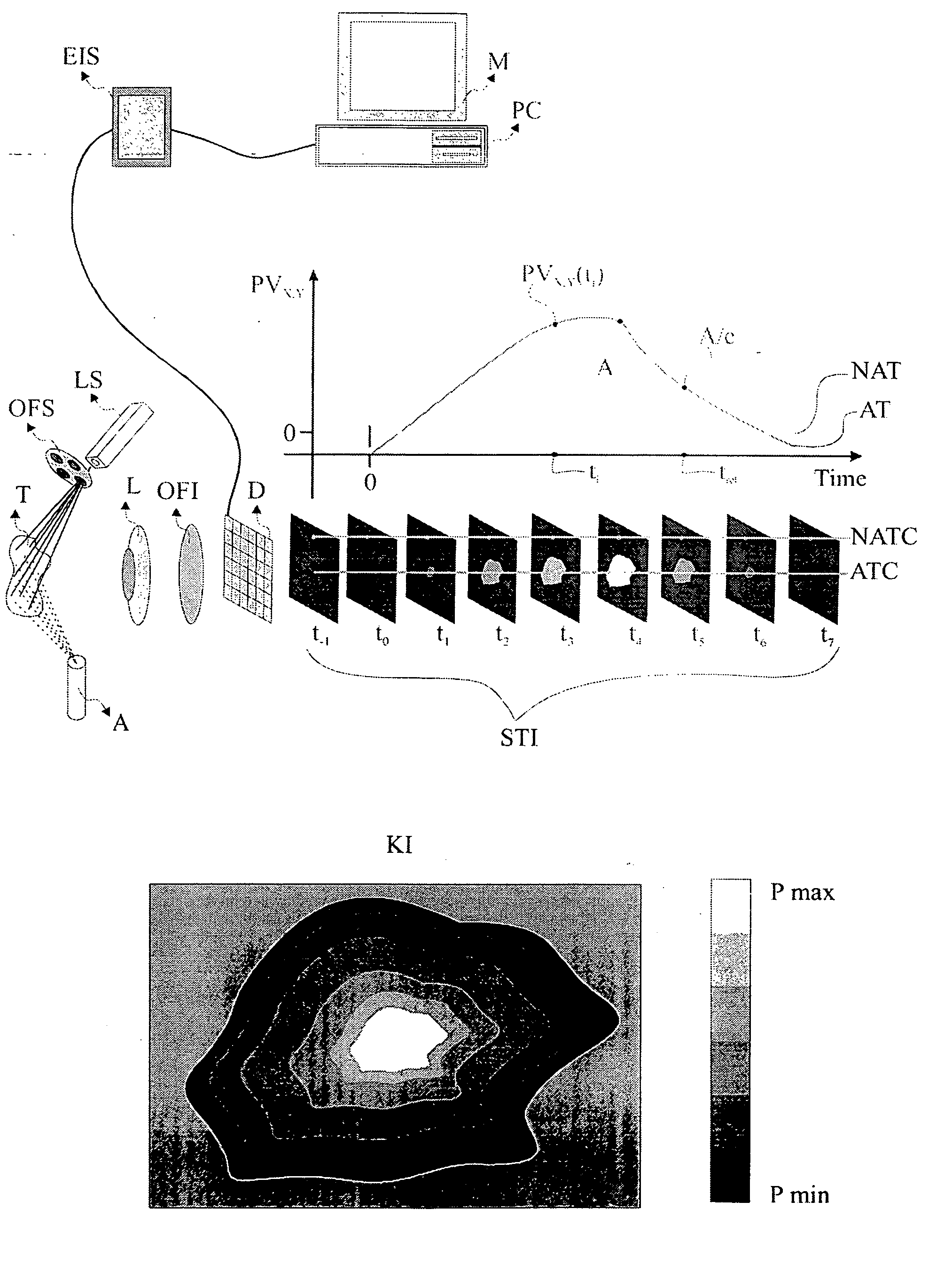 Method and system for characterization and mapping of tissue lesions