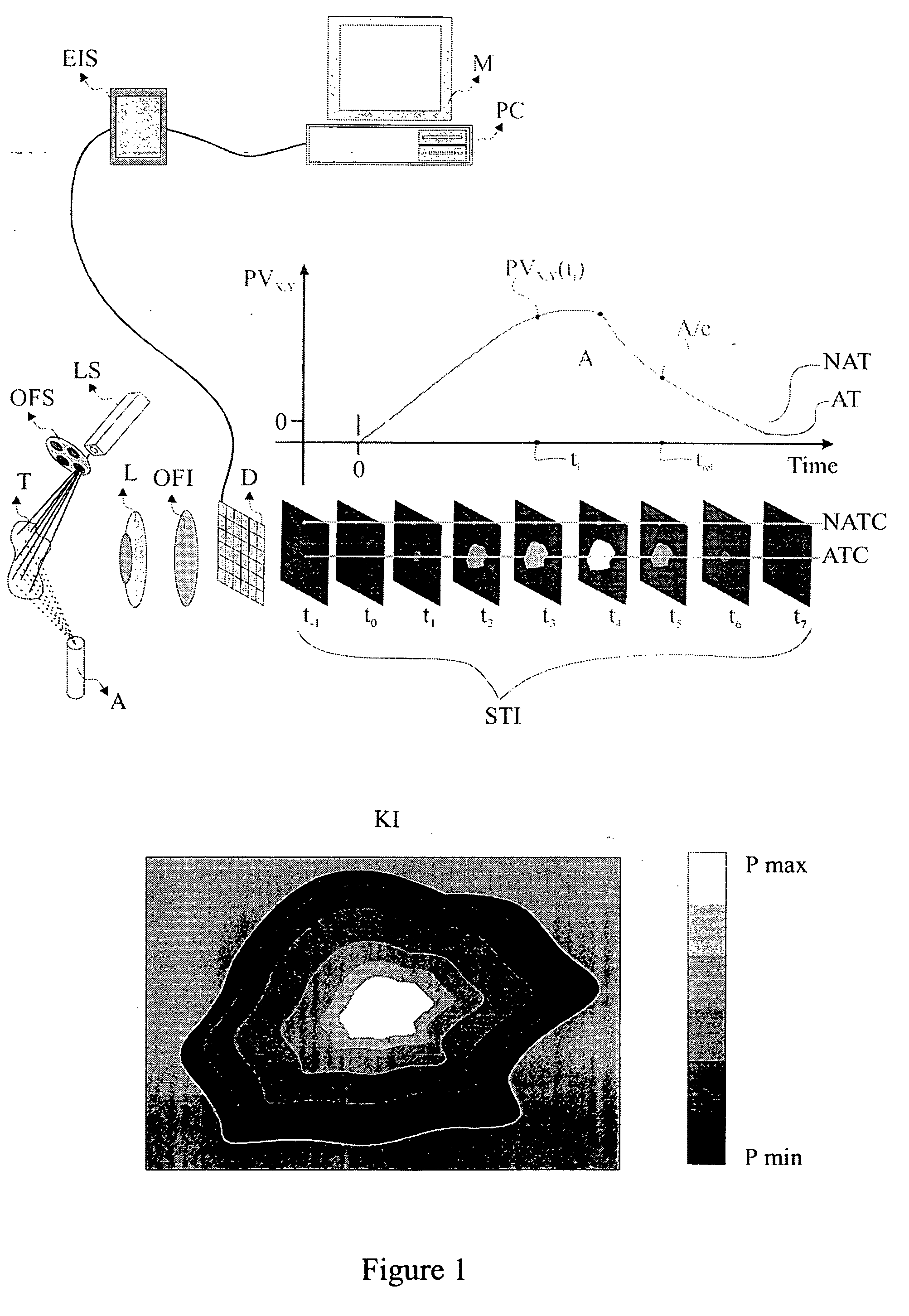 Method and system for characterization and mapping of tissue lesions