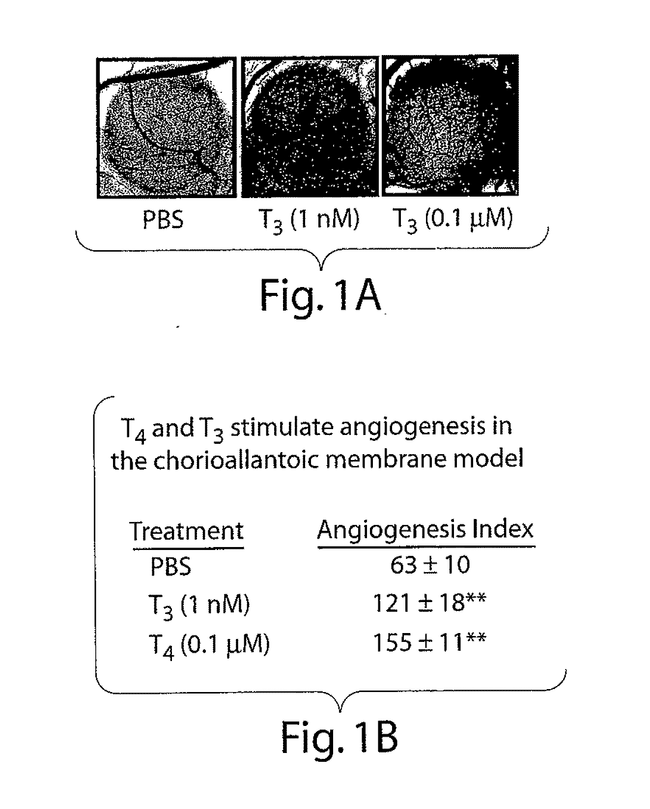 Thyroid Hormone Analogs and Methods of Use