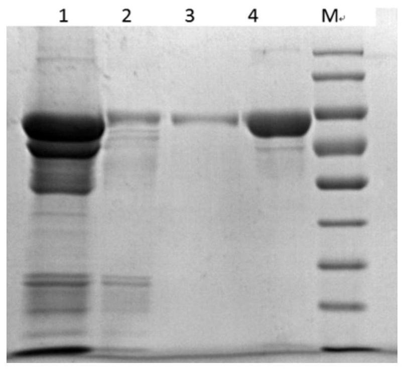 Preparation method and composition of human butyrylcholinesterase