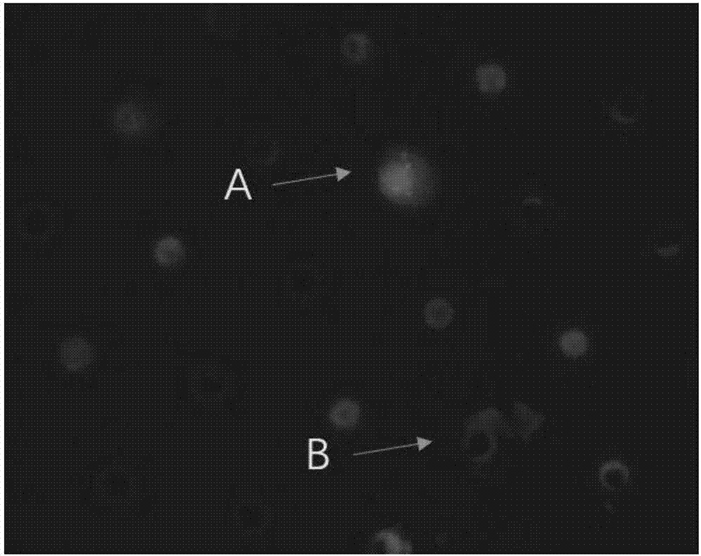 Kit for identification of circulating tumor cells through combination of CD45 immunofluorescence and CEP17 probe and use thereof