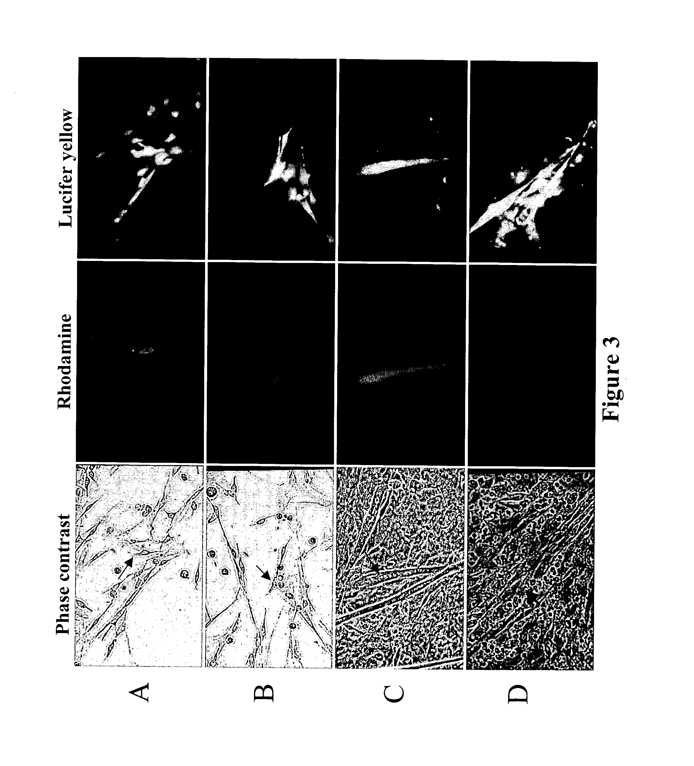 Methods and compositions for correction of cardiac conduction disturbances