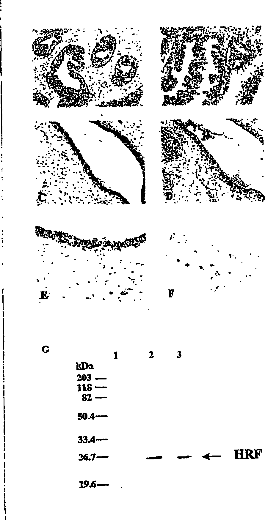 Method for diagnosing endometriosis-related disease in womb