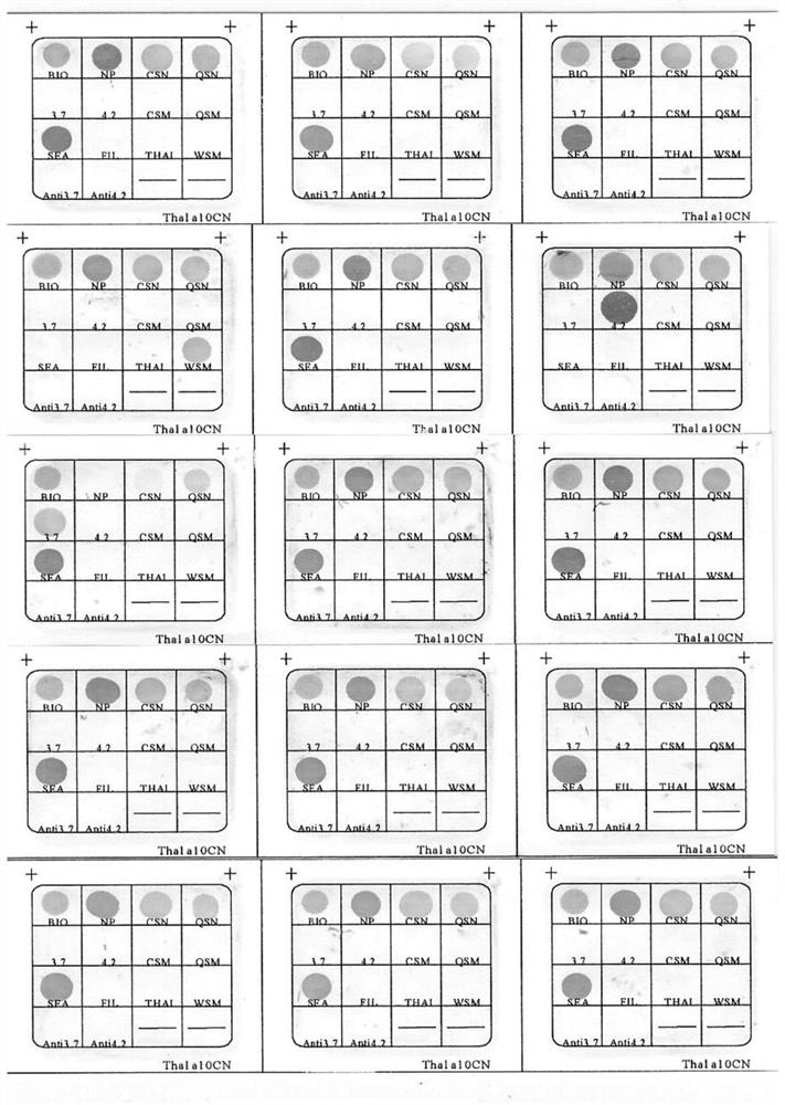 A nucleic acid composition for detecting α-thalassemia, its gene chip, its kit and its application