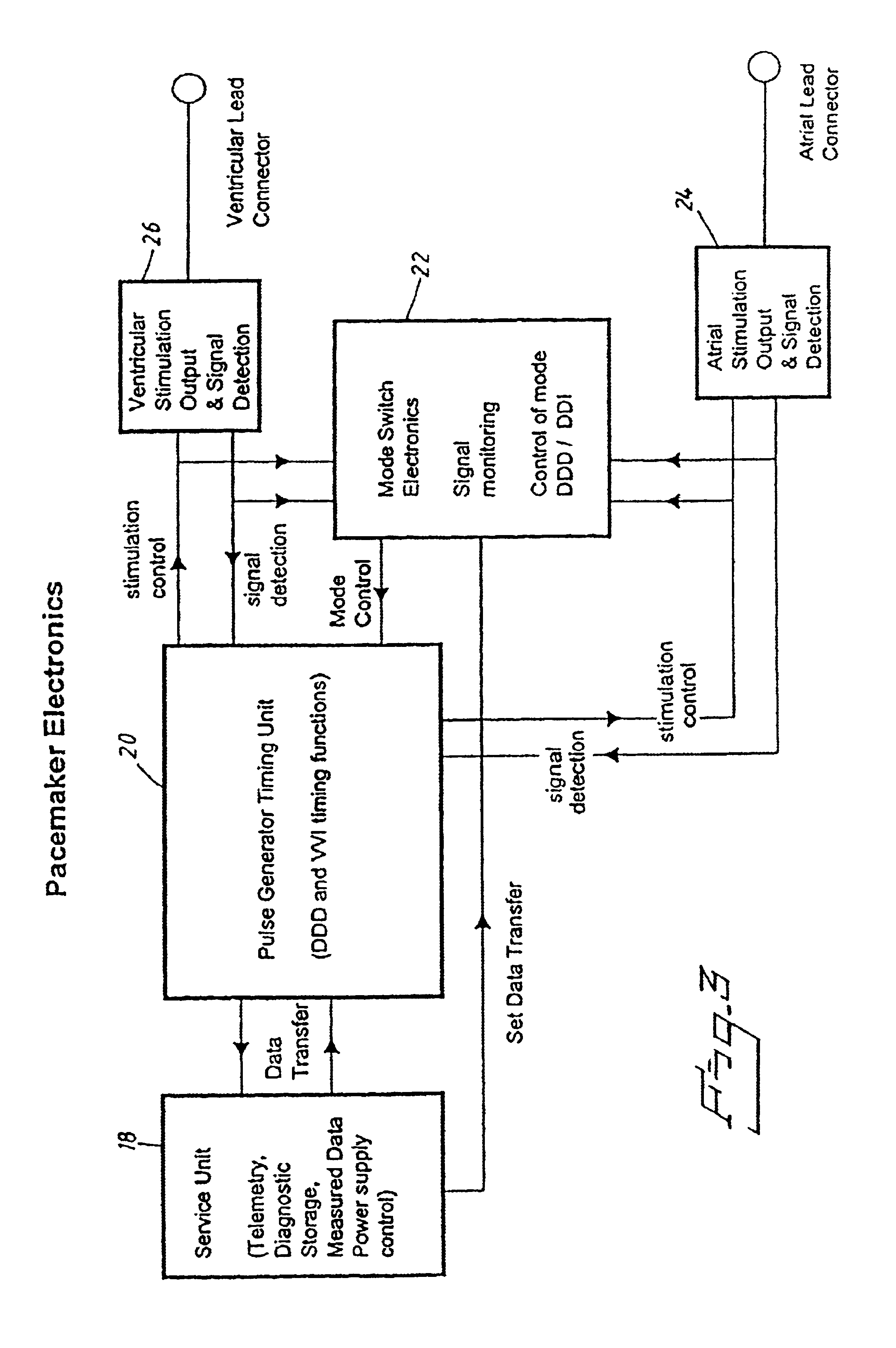Pacemaker using measured intervals for mode switching