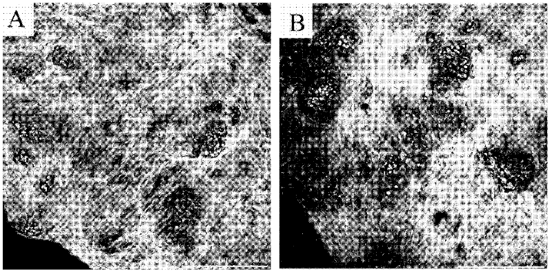 Preparation method of interpenetrating network composite hydrogel