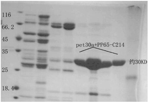 Hybridoma cell strain C11-6F7 as well as produced human cytomegalovirus (HCMV) monoclonal antibody and application thereof