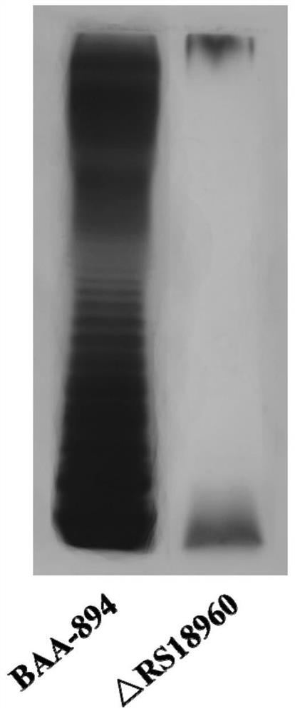 Recombinant cronobacter sakazakii and application thereof