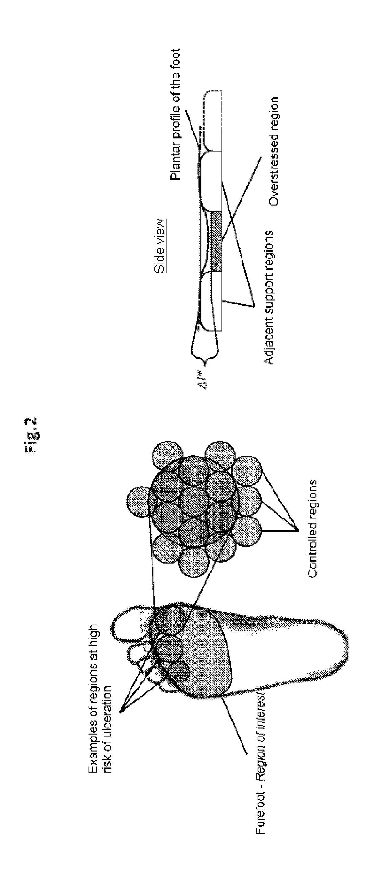 System for Adjusting Pressure Locally on the Skin and Subcutaneous Tissue