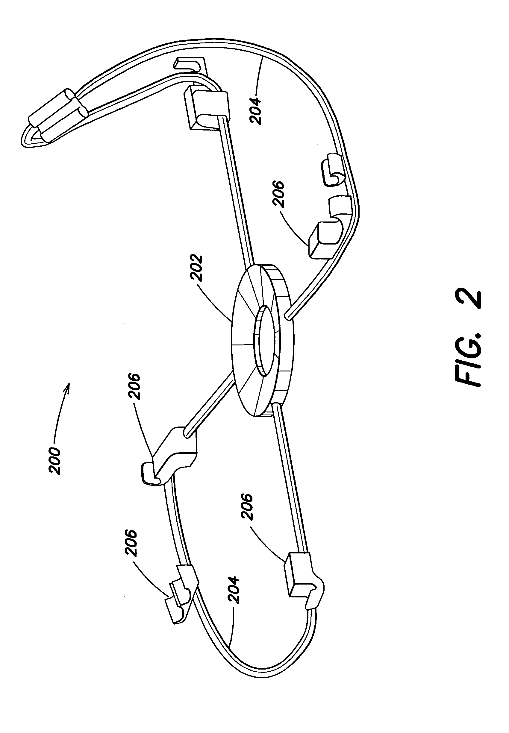 Device to stabilize and align a pre-mounted stent