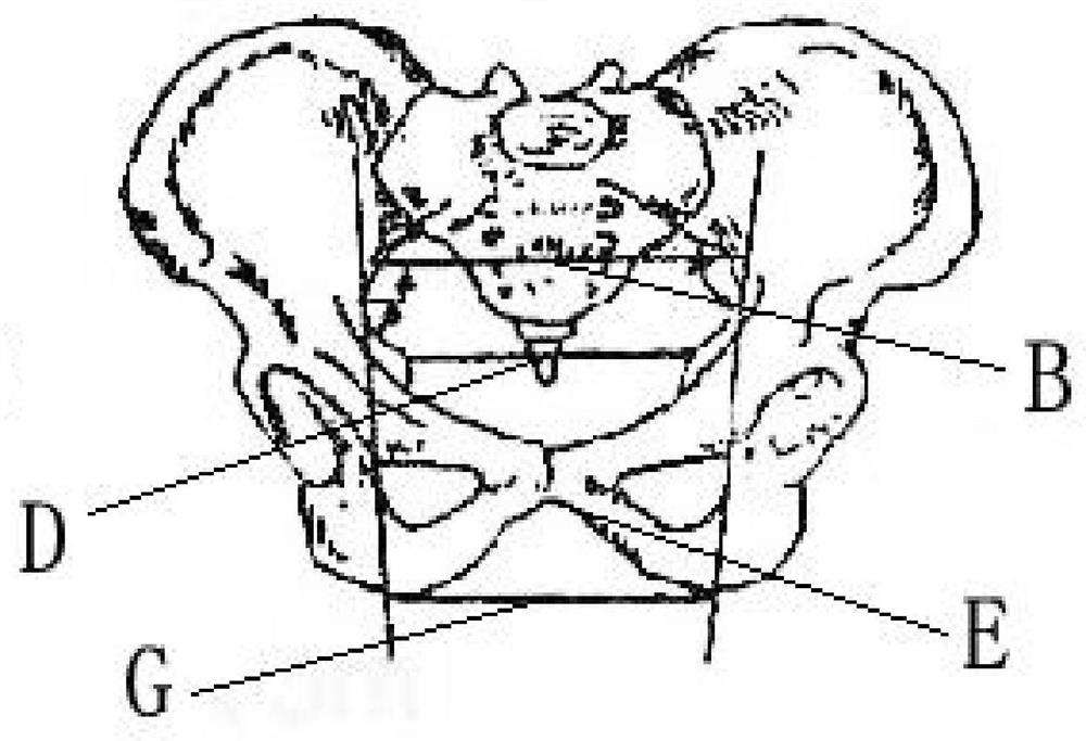 Pelvis plane center measuring and calculating method based on pelvis model and application thereof