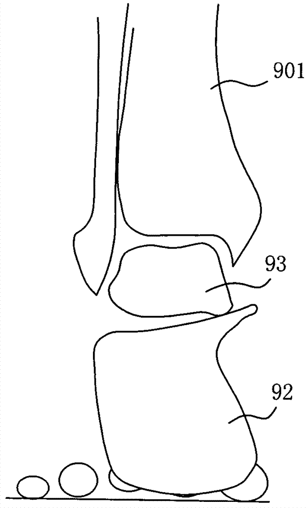 Arch correction pad capable of finely adjusting correction area and correction method of arch correction pad