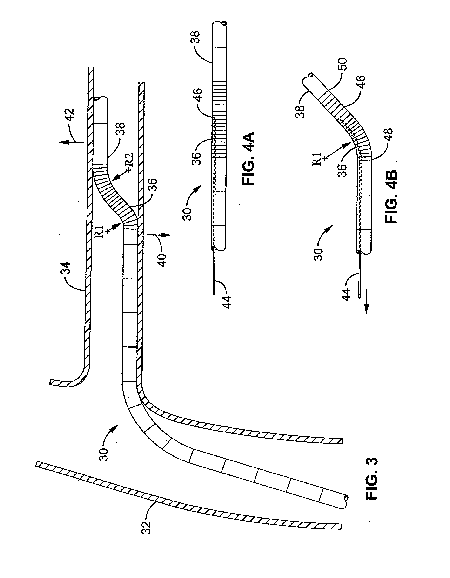 Method and apparatus for selective material delivery via an intra-renal catheter