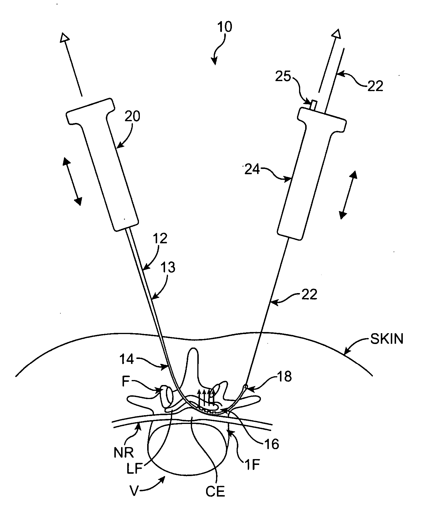 Tissue Removal with at Least Partially Flexible Devices