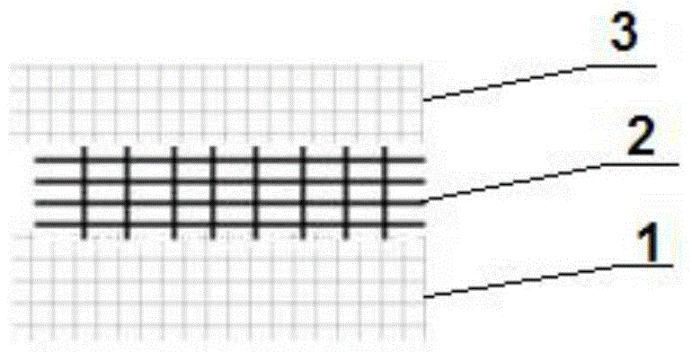 A kind of medical wound dressing with anti-infection function